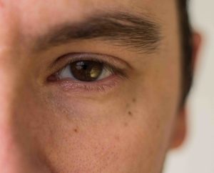 EMDR Ploërmel Vannes hypnose